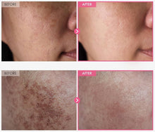 Load image into Gallery viewer, Arbutin 7% + Tranexamic Acid 4% Cream