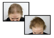 Load image into Gallery viewer, ANTEAGE MD
Hair Growth Factor Solution 2mL
